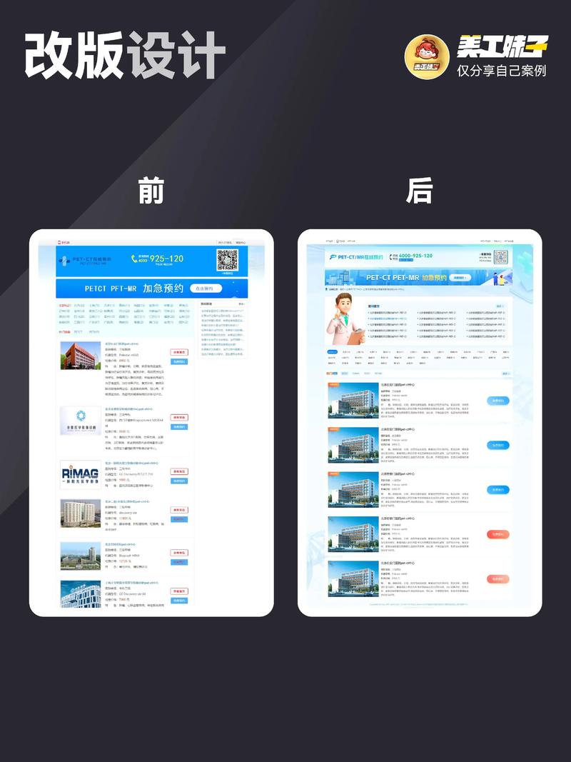 APP开发